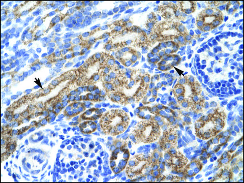 Anti-TAL1 antibody produced in rabbit