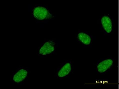ANTI-ATOH1 antibody produced in mouse