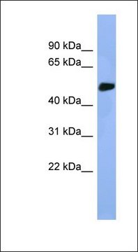 Anti-STK25 antibody produced in rabbit