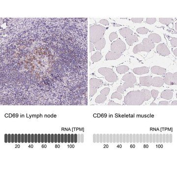 Anti-CD69 antibody produced in rabbit