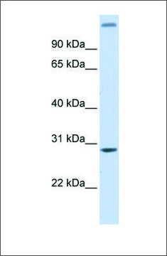 Anti-ALKBH2 antibody produced in rabbit