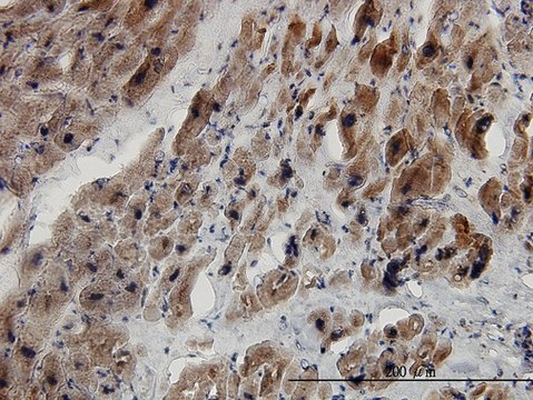 Monoclonal Anti-SMAD2 antibody produced in