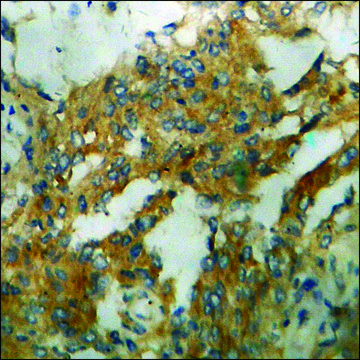 Anti-phospho-IL-8R ?/CDw128 ? (pSer³??) antibody
