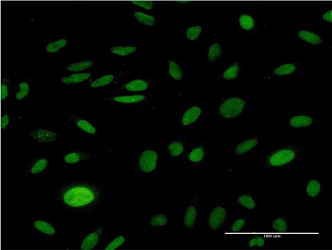 Monoclonal Anti-CMAS antibody produced in