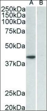 Anti-TBP antibody produced in goat