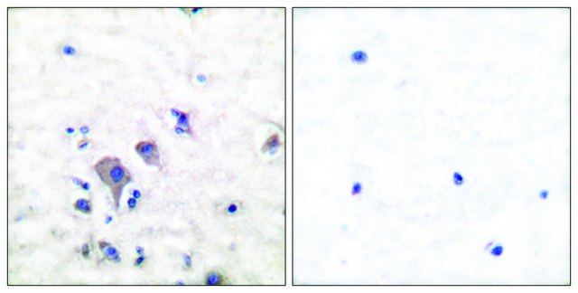 Anti-MGLUR2 antibody produced in rabbit