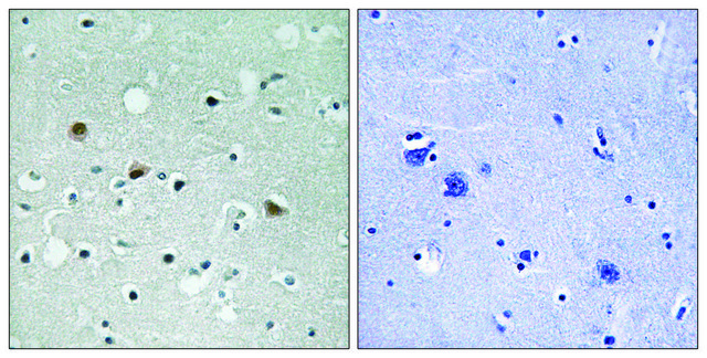 Anti-phospho-LATS1/2 (pThr1079/1041) antibody produced in