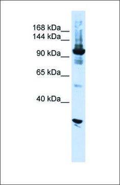 Anti-DIS3 antibody produced in rabbit