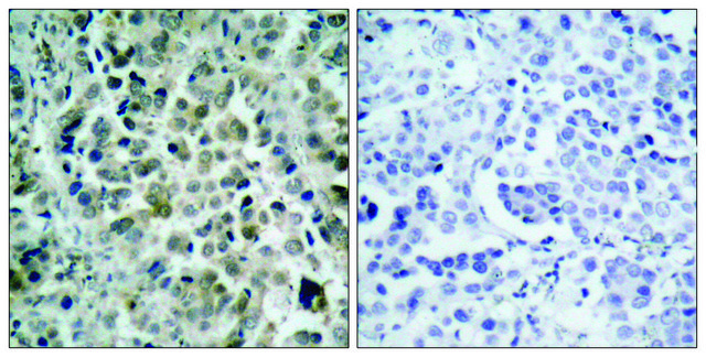 Anti-HDAC8 antibody produced in rabbit