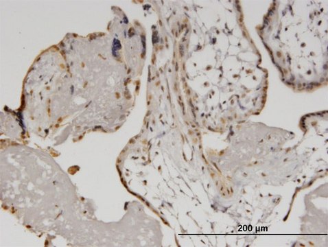 Monoclonal Anti-HELZ, (N-terminal) antibody produced