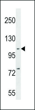 ANTI-NFKB(P105) (C-TERM S933) antibody produced