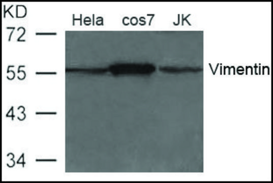 Anti-Vimentin antibody produced in rabbit