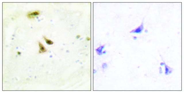 Anti-UBF1 antibody produced in rabbit