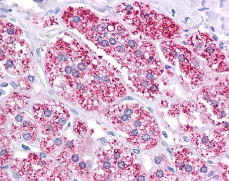 Anti-ABCB1 antibody produced in rabbit