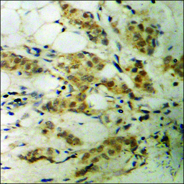 Anti-phospho-CDC2 (pThr¹?¹) antibody produced in