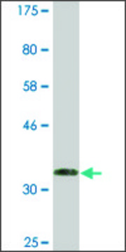 Monoclonal Anti-RRM2B antibody produced in