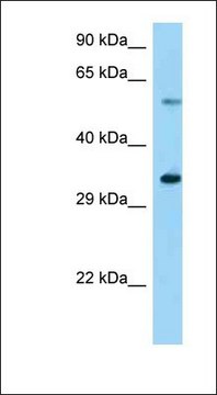 Anti-USP27X antibody produced in rabbit