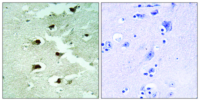 Anti-CDCA4 antibody produced in rabbit