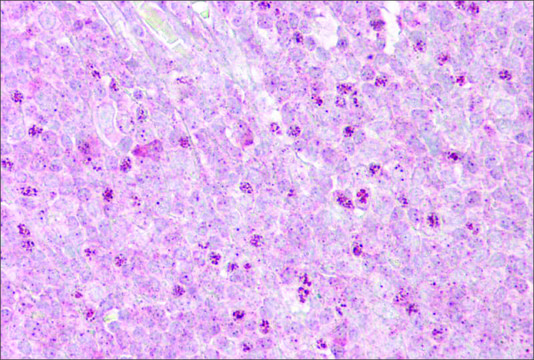 Anti-OAS1 antibody produced in rabbit