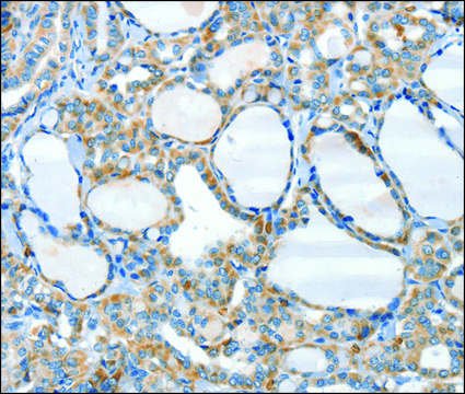 Anti-HID1 antibody produced in rabbit