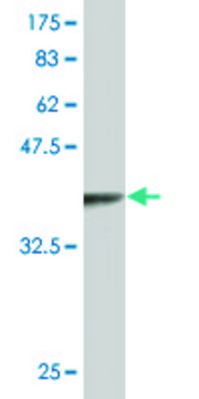 Monoclonal Anti-TLX3, (C-terminal) antibody produced