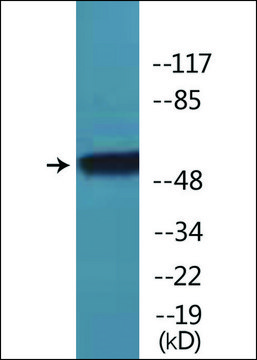 Anti-phospho-TR-?1 (pSer¹?²) antibody produced in