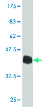 Monoclonal Anti-TRPV1 antibody produced in