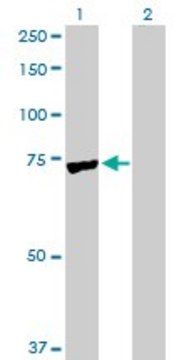 Anti-PAPSS2 antibody produced in rabbit