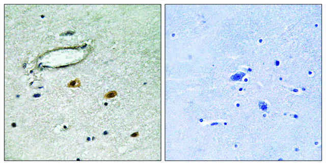 Anti-HSP27 antibody produced in rabbit