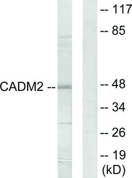 Anti-CADM2 antibody produced in rabbit