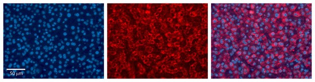 Anti-UGT1A6 antibody produced in rabbit