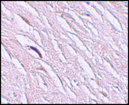 Anti-ZIP2 antibody produced in rabbit