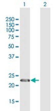 Anti-CENPN antibody produced in rabbit
