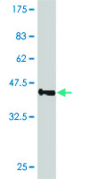 ANTI-SMO antibody produced in mouse