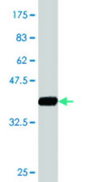 Monoclonal Anti-SPG3A, (N-terminal) antibody produced