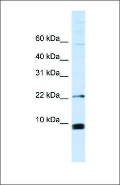 Anti-SNRPF antibody produced in rabbit