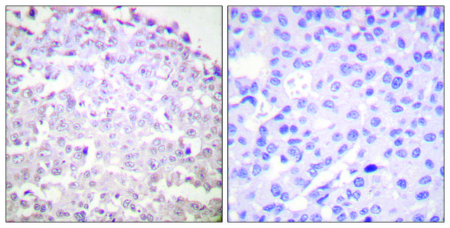 Anti-GADD153 antibody produced in rabbit
