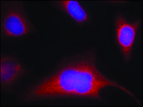 Anti-phospho-PRKD1 (pSer?¹?) antibody produced in
