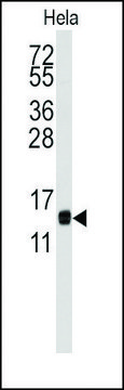 Anti-CDA (center) antibody produced in