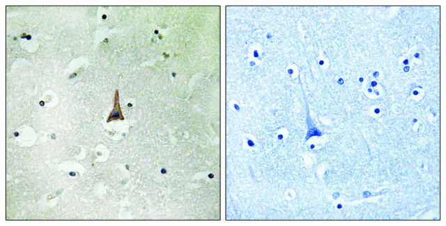 Anti-LRP10 antibody produced in rabbit
