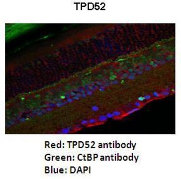 Anti-TPD52 antibody produced in rabbit