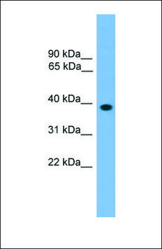 Anti-LHX8, (N-terminal) antibody produced in