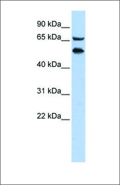 Anti-TADA2L (ab1) antibody produced in