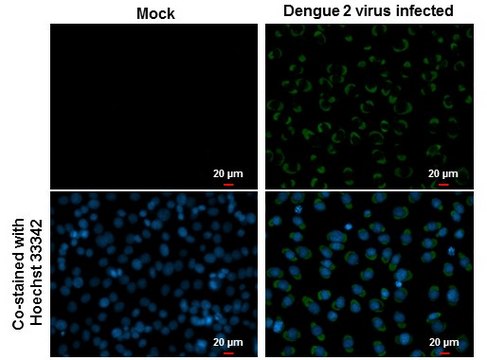 Monoclonal Anti-Dengue virus Envelope protein