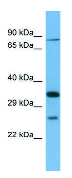 Anti-SLC6A9 (N-terminal) antibody produced in