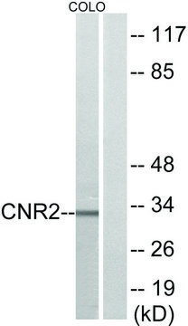 Anti-CNR2 antibody produced in rabbit