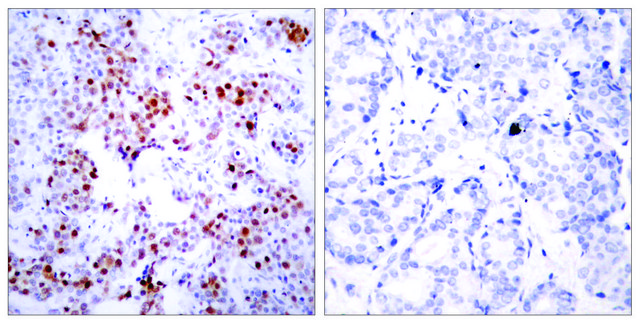 Anti-ATF2 antibody produced in rabbit
