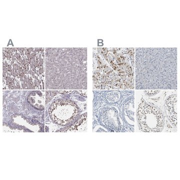 Anti-PKP2 antibody produced in rabbit