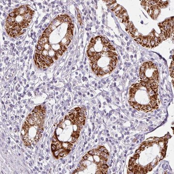 Anti-ANKRD18A antibody produced in rabbit