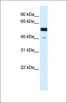 Anti-ZNF703 (ab2) antibody produced in